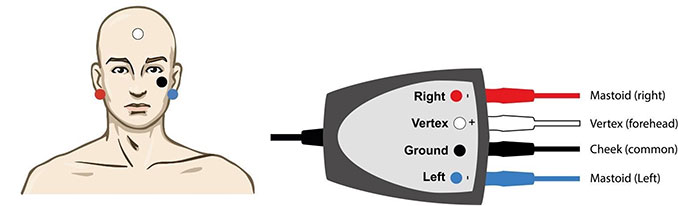 Auditory Steady State Response Test
