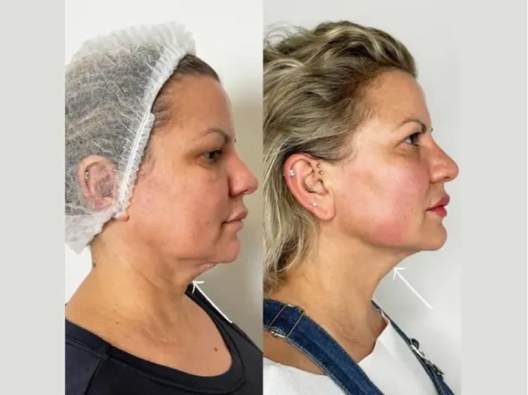 The Ultimate Guide to Finding the Best Plastic Surgeon in Dubai