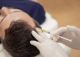 PRP Hair Treatment in London: Restore, Regrow & Revive Your Hair Naturally