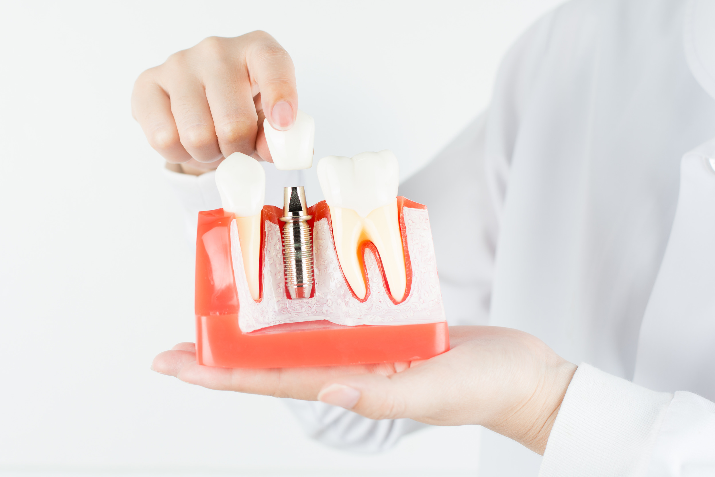 best root canal treatment