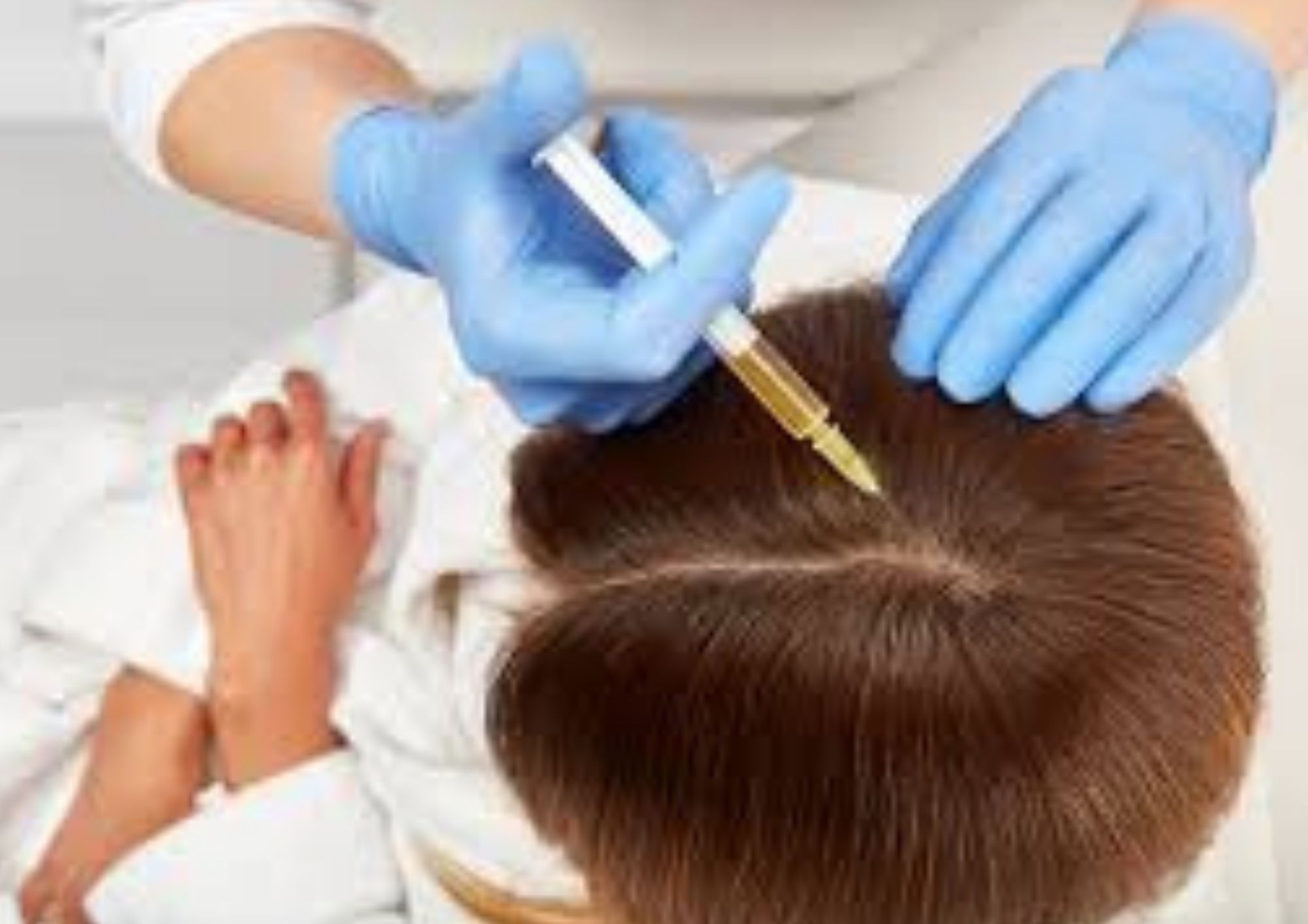 How Non-Surgical Hair Restoration Works: A Complete Guide