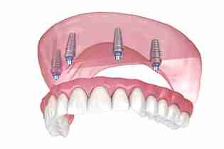 Image Source -Directory dental Liverpool