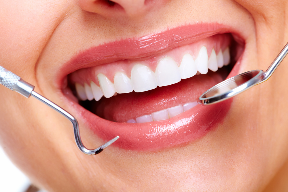 Dental Tooth Filling Dubai – Restore Your Smile